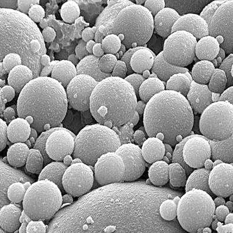 Cenospheres